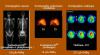 Bac PRO EN 2012 - E11 : médecine nucléaire (radiographie - scintigraphie)